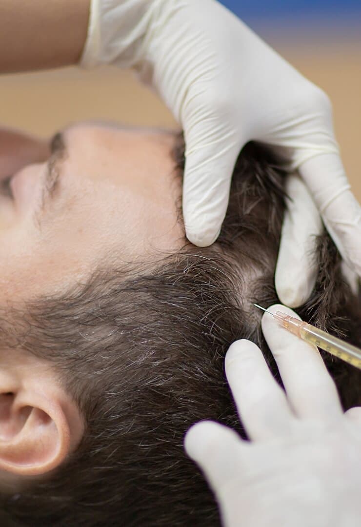 Exosome skin rejuvenation treatment