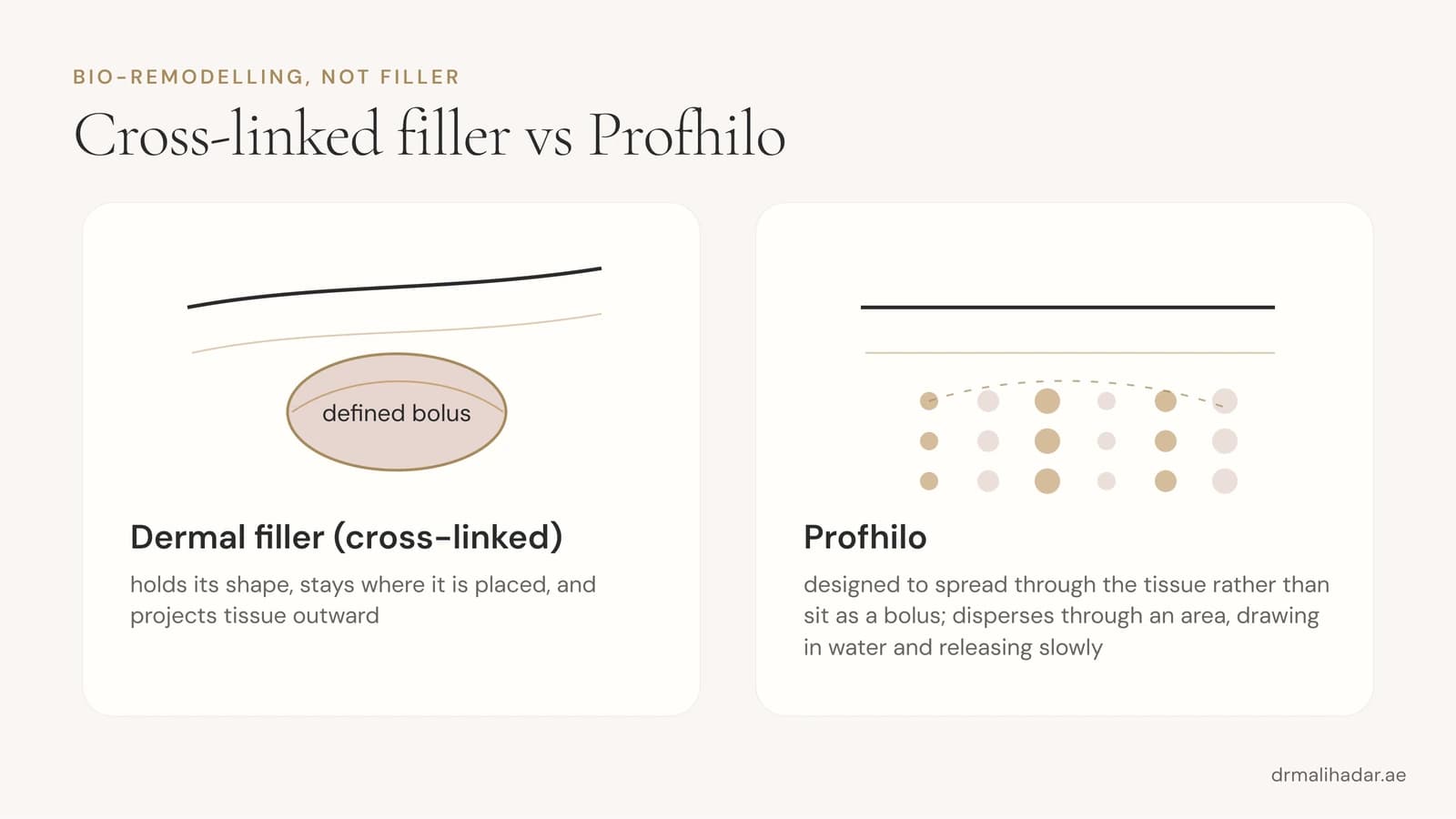 Cross-section comparing filler, which holds its shape at one point, with Profhilo, which spreads through the surrounding tissue